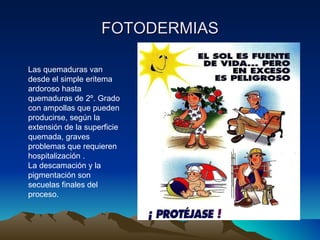 FOTODERMIAS Las quemaduras van desde el simple eritema ardoroso hasta quemaduras de 2º. Grado con ampollas que pueden producirse, según la extensión de la superficie quemada, graves problemas que requieren hospitalización . La descamación y la pigmentación son secuelas finales del proceso. 