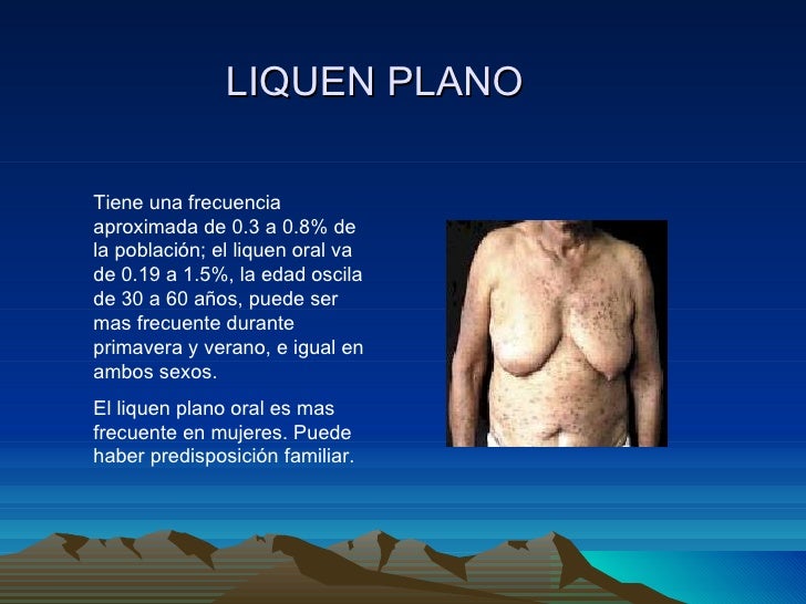 Si puede surgir la psoriasis por los nervios