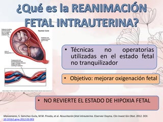 • Técnicas no operatorias
utilizadas en el estado fetal
no tranquilizador
• Objetivo: mejorar oxigenación fetal
• NO REVIERTE EL ESTADO DE HIPOXIA FETAL
Manzanares, S. Sámchez-Guila, M.M. Pineda, et al. Resucitación fetal intrauterina. Elservier Doyma. Clin Invest Gin Obst. 2012. DOI:
10.1016/j.gine.2012.03.003
 