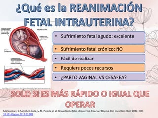 • Sufrimiento fetal agudo: excelente
• Sufrimiento fetal crónico: NO
• Fácil de realizar
• Requiere pocos recursos
• ¿PARTO VAGINAL VS CESÁREA?
Manzanares, S. Sámchez-Guila, M.M. Pineda, et al. Resucitación fetal intrauterina. Elservier Doyma. Clin Invest Gin Obst. 2012. DOI:
10.1016/j.gine.2012.03.003
 