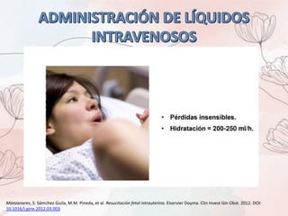 Manzanares, S. Sámchez-Guila, M.M. Pineda, et al. Resucitación fetal intrauterina. Elservier Doyma. Clin Invest Gin Obst. 2012. DOI:
10.1016/j.gine.2012.03.003
 