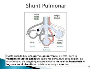 13
Existe cuando hay una perfusión normal al alvéolo, pero la
ventilación no es capaz de suplir las demandas de la región. Es
una cantidad de sangre que normalmente no realiza hematosis e
ingresa en el circuito arterial como sangre venosa.
 