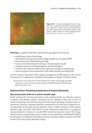 Chapter 5: Diabetic Retinopathy ● 119
Vitrectomy ​
In patients with PDR, indications for pars plana vitrectomy are
• nonclearing vitreous hemorrhage
• substantial recurring vitreous hemorrhage, despite use of maximal PRP
• dense premacular subhyaloid hemorrhage
• traction ret­
i­
nal detachment involving or threatening the macula
• combined traction and rhegmatogenous ret­
i­
nal detachment
• red blood cell–­
induced (erythroclastic) glaucoma and ghost cell glaucoma
• anterior segment neovascularization with media opacities preventing PRP
A more extensive discussion of the surgical management of PDR appears in the section
Vitrectomy for Complications of Diabetic Retinopathy in Chapter 19 of this volume.
Recchia FM, Scott IU, Brown GC, Brown MM, Ho AC, Ip MS. Small-­
gauge pars plana
vitrectomy: a report by the American Acad­
emy of Ophthalmology. Ophthalmology.
2010;117(9):1851–1857.
Additional Vision-­
Threatening Complications of Diabetic Retinopathy
Neovascularization of the iris or anterior chamber ­
angle
Small, isolated tufts of neovascularization at the pupillary border are relatively common
in patients with diabetes mellitus. Treatment may be withheld in ­
these eyes in ­
favor of
careful monitoring, with relatively short intervals between slit-­
lamp and gonioscopic ex-
aminations. However, treatment should be considered for eyes that have contiguous neo-
vascularization of the pupil and iris collarette, with or without inclusion of the anterior
chamber ­
angle, and when wide-­
field FA reveals widespread nonperfusion or peripheral
neovascularization. Treatment is usually PRP; intravitreal injection of anti-­
VEGF drugs
may be used as a temporizing mea­sure to reduce neovascularization ­until definitive PRP is
administered. Development of peripheral anterior synechiae despite treatment with PRP
or anti-­
VEGF may require glaucoma surgery.
Figure 5-10 Fundus photo­
graph shows an eye
that has under­
gone panret­
i­
nal photocoagula-
tion treatment. ­
Laser scars are characterized
by ­
either chorioret­
i­
nal and ret­
i­
nal pigment epi-
thelium (RPE) atrophy or RPE hyperpigmenta-
tion. (Courtesy of Jennifer K. Sun, MD, MPH.)
 