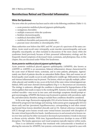 250 ● Retina and Vitreous
Noninfectious Ret­
i­
nal and Choroidal Inflammation
White Dot Syndromes
The term white dot syndromes has been used to refer to the following conditions (­Table 11-1):
• acute posterior multifocal placoid pigment epitheliopathy
• serpiginous choroiditis
• multiple evanescent white dot syndrome
• birdshot chorioretinopathy
• multifocal choroiditis (MFC)
• multifocal choroiditis and panuveitis syndrome
• punctate inner choroiditis or choroidopathy (PIC)
Many authorities now believe that MFC and PIC are part of a spectrum of the same con-
dition. Acute zonal occult outer retinopathy, acute macular neuroretinopathy, and acute
idiopathic maculopathy are often included in discussions of the more classic white dot
syndromes listed previously ­
because of their presumed inflammatory etiology and the
frequently shared symptoms of decreased vision, scotomata, and photopsias; thus, in this
chapter, they are discussed ­
under White Dot Syndromes.
Acute posterior multifocal placoid pigment epitheliopathy
Acute posterior multifocal placoid pigment epitheliopathy (APMPPE; also known as
AMPPPE or AMPPE) is an uncommon, bilateral inflammatory disease characterized by
the acute onset of blurred vision, scotomata, and in some patients, photopsias. Approxi-
mately one-­
third of patients describe an antecedent flulike illness. Men and ­
women are af-
fected equally; onset usually occurs in early adulthood to ­
middle age. Mild anterior chamber
and vitreous inflammation may be pre­
sent. The lesions, which are typically multiple, yellow-­
white, placoid, and variable in size, occur at the level of the outer ret­
ina (ret­
i­
nal pigment epi-
thelium, RPE) and inner choroid (choriocapillaris) (Fig 11-1). Recurrences are uncommon.
The etiology is unknown, although the condition is characterized by hypoperfusion of the
choriocapillaris that results in injury to the overlying RPE. Systemic involvement—­
especially
ce­
re­
bral vasculitis—­
may occur in rare cases, and neurologic symptoms should prompt ur-
gent neuroimaging. APMPPE-­
like lesions may be pre­
sent in patients with sarcoidosis, syph-
ilis, and tuberculosis; therefore, testing to exclude ­
these conditions should be considered.
In the acute stage, fluorescein angiography (FA) of active lesions shows early blockage
followed by progressive late leakage and staining. Indocyanine green angiography (ICGA)
shows early and late (per­
sis­
tent) hypofluorescence, corresponding to and often extend-
ing beyond ­
those lesions identified clinically and on FA. Optical coherence tomography
(OCT) through active lesions reveals outer ret­
i­
nal lesions associated with disruption of
the outer ret­i­nal hyperreflective bands. Autofluorescence in and around active lesions var-
ies over time and may be ­either increased or decreased at pre­sen­ta­tion; it tends to decrease
as disease activity subsides. With time, hypoautofluorescence develops in areas of RPE
disruption. The fundus appearance and visual symptoms typically improve within weeks.
­
There is no definitive evidence that treatment with corticosteroids is beneficial in
altering the outcome for APMPPE, but systemic corticosteroids are required in cases with
 