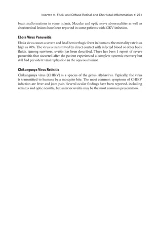Chapter 11: Focal and Diffuse Ret­
i­
nal and Choroidal Inflammation ● 281
brain malformations in some infants. Macular and optic nerve abnormalities as well as
chorioret­
i­
nal lesions have been reported in some patients with ZIKV infection.
Ebola Virus Panuveitis
Ebola virus ­
causes a severe and fatal hemorrhagic fever in ­
humans; the mortality rate is as
high as 90%. The virus is transmitted by direct contact with infected blood or other body
fluids. Among survivors, uveitis has been described. ­
There has been 1 report of severe
panuveitis that occurred ­
after the patient experienced a complete systemic recovery but
still had per­
sis­
tent viral replication in the aqueous humor.
Chikungunya Virus Retinitis
Chikungunya virus (CHIKV) is a species of the genus Alphavirus. Typically, the virus
is transmitted to ­
humans by a mosquito bite. The most common symptoms of CHIKV
infection are fever and joint pain. Several ocular findings have been reported, including
retinitis and optic neuritis, but anterior uveitis may be the most common pre­
sen­
ta­
tion.
 
