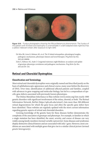 288 ● Retina and Vitreous
De Silva SR, Arno G, Robson AG, et al. The X-­
linked retinopathies: physiological insights,
pathogenic mechanisms, phenotypic features and novel therapies. Prog Retin Eye Res.
2021;82:100898.
Zeitz C, Robson AG, Audo I. Congenital stationary night blindness: an analy­
sis and update
of genotype-­
phenotype correlations and pathogenic mechanisms. Prog Retin Eye Res.
2015;45:58–110.
Ret­
i­
nal and Choroidal Dystrophies
Classification and Terminology
Most ret­i­nal and choroidal dystrophies ­were originally named and described purely on the
basis of ophthalmoscopic appearance and clinical course, many years before the discovery
of DNA. Over time, identification of additional affected patients and families, coupled
with advances in gene mapping and molecular biology, has led to a compendium of spe-
cific gene defects associated with previously known phenotypes.
The Online Mendelian Inheritance in Man website (www​.­omim​.­org) lists nearly 1000
ge­
ne­
tic disorders with significant involvement of the ret­
ina, choroid, or both. The Ret­
i­
nal
Information Network, RetNet (https://­sph​.­uth​.­edu​/­retnet​/­
), lists more than 300 dif­
fer­
ent
ret­
i­
nal degenerations for which the gene locus and often the specific gene defect have
been identified. ­
These websites are regularly updated with the most current information
regarding ge­
ne­
tic aspects of ret­
i­
nal and choroidal disorders.
Growing knowledge of the ge­
ne­
tic basis for ­
these diseases further demonstrates the
complexity of the association of genotype and phenotype. For example, in families in which
a single mutation has been identified, the onset, severity, and course of disease can vary
widely among ­family members (termed variable expressivity). Some diseases and syndromes
display distinctive clinical features and are associated with only 1 gene. However, most con-
ditions are associated with multiple genes that give rise to a similar clinical picture (termed
ge­ne­tic heterogeneity).
Figure 12-5 Fundus photo­
graphs showing the Mizuo-­
Nakamura phenomenon. The fundus of
this patient with X-­
linked cone dystrophy is unremarkable in a dark-­
adapted state (right) but has
a yellow iridescent sheen ­
after exposure to light (left).
 