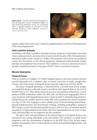 300 ● Retina and Vitreous
arginine intake and, in some cases, vitamin B6 supplementation can slow or halt progression
of the ret­
i­
nal degeneration.
Bietti crystalline dystrophy
Individuals with Bietti crystalline dystrophy develop symptoms of nyctalopia, decreased
vision, and paracentral scotomata in the second to fourth de­cades of life. On examination,
intraret­
i­
nal yellow-­
white crystals are vis­
i­
ble in the posterior ret­
ina and in the peripheral
cornea near the limbus. As the disease progresses, widespread retinochoroidal atrophy
develops and peripheral vision worsens. The condition is a very rare autosomal recessive
disorder caused by mutations in the gene CYP4V2. ­
There is no known treatment.
Macular Dystrophies
Stargardt disease
With an incidence of roughly 1 in 10,000, Stargardt disease is the most common juvenile
macular dystrophy and a common cause of central vision loss in adults younger than
50 years. The visual acuity in Stargardt disease typically ranges from 20/50 to 20/200.
The classic Stargardt phenotype is characterized by a juvenile-­
onset foveal atrophy
surrounded by discrete, yellowish, round or pisciform (fish-­
shaped) flecks at the level of
the RPE (Fig 12-15). ­
These flecks represent excessive accumulation of lipofuscin, a waste
product of RPE metabolism, within the RPE cells. On fluorescein angiography, 80% or
more of patients with Stargardt disease have a “dark choroid,” in which blocking of choroi-
dal fluorescence by swollen, lipofuscin-­
laden RPE cells accentuates the ret­
i­
nal circulation
(see Fig 12-15B). FAF imaging is a more reliable means of demonstrating elevated back-
ground autofluorescence and characteristic findings, including peripapillary sparing of
RPE changes, central macular hypoautofluorescence, and over time, an outward expand-
ing pattern of hyperautofluorescent flecks that leave hypoautofluorescent areas in their
wake. Full-­
field ERGs are not diagnostic for this condition.
The age at onset and pre­
sen­
ta­
tion of the clinical features in Stargardt disease vary,
sometimes even among individuals in the same ­
family. The condition is usually slowly
progressive with the accumulation of lipofuscin in the RPE (Fig 12-16). In ­
later stages,
atrophic maculopathy, with or without lipofuscin flecks and panret­
i­
nal degeneration, can
be observed.
Figure 12-14 Gyrate atrophy. Wide-­
angle fun-
dus photo­
graph shows scalloped edges of
the remaining posterior ret­
ina, as is typically
seen in gyrate atrophy. A crescent of nasal
macular atrophy is also pre­
sent. (Courtesy of
Colin A. McCannel, MD.)
 