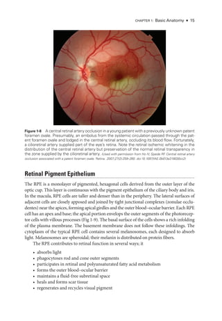 Chapter 1: Basic Anatomy ● 15
Ret­i­nal Pigment Epithelium
The RPE is a monolayer of pigmented, hexagonal cells derived from the outer layer of the
optic cup. This layer is continuous with the pigment epithelium of the ciliary body and iris.
In the macula, RPE cells are taller and denser than in the periphery. The lateral surfaces of
adjacent cells are closely apposed and joined by tight junctional complexes (zonulae occlu-
dentes) near the apices, forming apical girdles and the outer blood–­ocular barrier. Each RPE
cell has an apex and base; the apical portion envelops the outer segments of the photorecep-
tor cells with villous pro­
cesses (Fig 1-9). The basal surface of the cells shows a rich infolding
of the plasma membrane. The basement membrane does not follow ­
these infoldings. The
cytoplasm of the typical RPE cell contains several melanosomes, each designed to absorb
light. Melanosomes are spheroidal; their melanin is distributed on protein fibers.
The RPE contributes to ret­
i­
nal function in several ways; it
• absorbs light
• phagocytoses rod and cone outer segments
• participates in ret­
i­
nal and polyunsaturated fatty acid metabolism
• forms the outer blood–­
ocular barrier
• maintains a fluid-­
free subret­
i­
nal space
• heals and forms scar tissue
• regenerates and recycles visual pigment
Figure 1-8 A central ret­
i­
nal artery occlusion in a young patient with a previously unknown patent
foramen ovale. Presumably, an embolus from the systemic circulation passed through the pat-
ent foramen ovale and lodged in the central ret­
i­
nal artery, occluding its blood flow. Fortunately,
a cilioret­
i­
nal artery supplied part of the eye’s ret­
ina. Note the ret­
i­
nal ischemic whitening in the
distribution of the central ret­
i­
nal artery but preservation of the normal ret­
i­
nal transparency in
the zone supplied by the cilioret­
i­
nal artery. (Used with permission from Ho IV, Spaide RF
. Central ret­
i­
nal artery
occlusion associated with a patent foramen ovale. Ret­i­na. 2007;27(2):259–260. doi:10.1097/IAE.0b013e318030cc2)
 