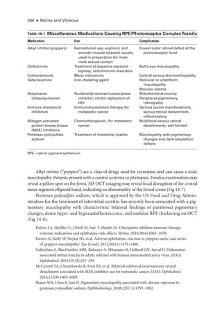 340 ● Retina and Vitreous
­Table 14-1 ​
Miscellaneous Medi­
cations Causing RPE/Photoreceptor ComplexToxicity
Medi­cation Use Complication
Alkyl nitrites (poppers) Recreational use; euphoric and
smooth muscle relaxant usually
used in preparation for male-­
male sexual contact
Foveal outer ret­
i­
nal defect at the
photoreceptor level
Clofazimine Treatment of dapsone-­
resistant
leprosy, autoimmune disorders
Bull’s-­eye maculopathy
Corticosteroids Many indications Central serous chorioretinopathy
Deferoxamine Iron-­chelating agent Reticular or vitelliform
maculopathy
Macular edema
Didanosine
(dideoxyinosine)
Nucleoside reverse transcriptase
inhibitor; inhibit replication of
HIV
Mitochondrial toxicity
Peripheral pigmentary
retinopathy
Immune checkpoint
inhibitors
Immunomodulatory therapy for
metastatic cancer
Vari­
ous ocular manifestations,
serous ret­i­nal detachment,
inflammatory
Mitogen-­activated
protein kinase kinase
(MEK) inhibitors
Chemotherapeutic, for metastatic
cancer
Multifocal serous ret­i­nal
detachments, self-­limited
Pentosan polysulfate
sodium
Treatment of interstitial cystitis Maculopathy with pigmentary
changes and dark-­
adaptation
defects
RPE  = ret­i­nal pigment epithelium.
Alkyl nitrites (“poppers”) are a class of drugs used for recreation and can cause a toxic
maculopathy. Patients pre­
sent with a central scotoma or photopsia. Fundus examination may
reveal a yellow spot on the fovea. SD-­
OCT imaging may reveal focal disruption of the central
inner segment ellipsoid band, indicating an abnormality of the foveal cones (Fig 14-7).
Pentosan polysulfate sodium, which is approved by the US Food and Drug Admin-
istration for the treatment of interstitial cystitis, has recently been associated with a pig-
mentary maculopathy with characteristic bilateral findings of parafoveal pigmentary
changes, dense hypo-­and hyperautofluorescence, and nodular RPE thickening on OCT
(Fig 14-8).
Dalvin LA, Shields CL, Orloff M, Sato T, Shields JA. Checkpoint inhibitor immune therapy:
systemic indications and ophthalmic side effects. Ret­i­na. 2018;38(6):1063–1078.
Davies AJ, Kelly SP, Naylor SG, et al. Adverse ophthalmic reaction in poppers users: case series
of ‘poppers maculopathy’. Eye (Lond). 2012;26(11):1479–1486.
Gabrielian A, MacCumber MM, Kukuyev A, Mitsuyasu R, Holland GN, Sarraf D. Didanosine-­
associated ret­
i­
nal toxicity in adults infected with ­
human immunodeficiency virus. JAMA
Ophthalmol. 2013;131(2):255–259.
McCannel TA, Chmielowski B, Finn RS, et al. Bilateral subfoveal neurosensory ret­
i­
nal
detachment associated with MEK inhibitor use for metastatic cancer. JAMA Ophthalmol.
2014;132(8):1005–1009.
Pearce WA, Chen R, Jain N. Pigmentary maculopathy associated with chronic exposure to
pentosan polysulfate sodium. Ophthalmology. 2018;125(11):1793–1802.
 