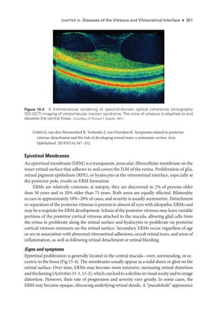 CHAPTER 15: Diseases of the Vitreous and Vitreoret­
i­
nal Interface ● 351
Gishti O, van den Nieuwenhof R, Verhoekx J, van Overdam K. Symptoms related to posterior
vitreous detachment and the risk of developing ret­
i­
nal tears: a systematic review. Acta
Ophthalmol. 2019;97(4):347–352.
Epiret­i­nal Membranes
An epiret­i­nal membrane (ERM) is a transparent, avascular, fibrocellular membrane on the
inner ret­
i­
nal surface that adheres to and covers the ILM of the ret­
ina. Proliferation of glia,
ret­
i­
nal pigment epithelium (RPE), or hyalocytes at the vitreoret­
i­
nal interface, especially at
the posterior pole, results in ERM formation.
ERMs are relatively common; at autopsy, they are discovered in 2% of persons older
than 50 years and in 20% older than 75 years. Both sexes are equally affected. Bilaterality
occurs in approximately 10%–20% of cases, and severity is usually asymmetric. Detachment
or separation of the posterior vitreous is pre­sent in almost all eyes with idiopathic ERMs and
may be a requisite for ERM development. Schisis of the posterior vitreous may leave variable
portions of the posterior cortical vitreous attached to the macula, allowing glial cells from
the ret­
ina to proliferate along the ret­
i­
nal surface and hyalocytes to proliferate on posterior
cortical vitreous remnants on the ret­
i­
nal surface. Secondary ERMs occur regardless of age
or sex in association with abnormal vitreoret­
i­
nal adhesions, occult ret­
i­
nal tears, and areas of
inflammation, as well as following ret­
i­
nal detachment or ret­
i­
nal bleeding.
Signs and symptoms
Epiret­
i­
nal proliferation is generally located in the central macula—­
over, surrounding, or ec-
centric to the fovea (Fig 15-4). The membranes usually appear as a mild sheen or glint on the
ret­
i­
nal surface. Over time, ERMs may become more extensive, increasing ret­
i­
nal distortion
andthickening(Activities15-1,15-2),whichcanleadtoadeclineinvisualacuityandtoimage
distortion. However, their rate of progression and severity vary greatly. In some cases, the
ERM may become opaque, obscuring under­
lying ret­
i­
nal details. A “pseudohole” appearance
Figure 15-2 A 3-­
dimensional rendering of spectral-­
domain optical coherence tomography
(SD-­
OCT) imaging of vitreomacular traction syndrome. The cone of vitreous is attached to and
elevates the central fovea. (Courtesy of Richard F
. Spaide, MD.)
 
