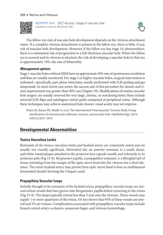 358 ● Retina and Vitreous
ACTIVITY 15-3 OCT Activity: Stage 3 macular hole.
Courtesy of Colin A. McCannel, MD.
The fellow-­
eye risk of macular hole development depends on the vitreous attachment
status. If a complete vitreous detachment is pre­
sent in the fellow eye, ­
there is ­
little, if any,
risk of macular hole development. However, if the fellow eye has stage 1A abnormalities,
­
there is a substantial risk of progression to a full-­
thickness macular hole. When the fellow
eye is normal and its vitreous is attached, the risk of developing a macular hole in that eye
is approximately 10%, the rate of bilaterality.
Management options
Stage 1 macular holes without ERM have an approximate 50% rate of spontaneous resolution
and thus are usually monitored. For stage 2 or higher macular holes, surgical intervention is
indicated—­
specifically, pars plana vitrectomy usually performed with ILM peeling and gas
tamponade. In most recent case series, the success rate of this procedure for closure and vi-
sion improvement was greater than 90% (see Chapter 19). Modifications of routine macular
hole surgery are usually reserved for very large, chronic, or nonclosing holes; ­
these include
inverted ILM flaps and autologous ret­
i­
nal grafts composed of peripheral ret­
ina. Although
­
these techniques may achieve anatomical hole closure, visual acuity may not improve.
Duker JS, Kaiser PK, ­
Binder S, et al. The International Vitreomacular Traction Study Group
classification of vitreomacular adhesion, traction, and macular hole. Ophthalmology. 2013;​
120(12):2611–2619.
Developmental Abnormalities
Tunica Vasculosa Lentis
Remnants of the tunica vasculosa lentis and hyaloid artery are commonly noted and are
usually not visually significant. Mittendorf dot, an anterior remnant, is a small, dense,
and white round plaque attached to the posterior lens capsule nasally and inferiorly to its
posterior pole (Fig 15-8). Bergmeister papilla, a prepapillary remnant, is a fibroglial tuft of
tissue extending from the margin of the optic nerve head into the vitreous for a short dis-
tance. The entire hyaloid artery may persist from optic nerve head to lens as multilayered
fenestrated sheaths forming the Cloquet canal.
Prepapillary Vascular Loops
Initially thought to be remnants of the hyaloid artery, prepapillary vascular loops are nor-
mal ret­
i­
nal vessels that have grown into Bergmeister papilla before returning to the ret­
ina
(Fig 15-9). The loops typically extend less than 5 mm into the vitreous. ­
These vessels may
supply 1 or more quadrants of the ret­
ina. FA has shown that 95% of ­
these vessels are arte-
rial and 5% are venous. Complications associated with prepapillary vascular loops include
branch ret­
i­
nal artery occlusion, amaurosis fugax, and vitreous hemorrhage.
 