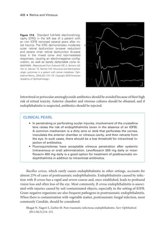 408 ● Retina and Vitreous
Intravitreal or periocular aminoglycoside antibiotics should be avoided ­because of their high
risk of ret­
i­
nal toxicity. Anterior chamber and vitreous cultures should be obtained, and if
endophthalmitis is suspected, antibiotics should be injected.
CLINICAL PEARL
• In penetrating or perforating ocular injuries, involvement of the crystalline
lens raises the risk of endophthalmitis (even in the absence of an IOFB).
A common mechanism is a dirty wire or stick that perforates the cornea,
inoculates the anterior chamber or vitreous cavity, and then retracts from
the eye. In such cases, ­
there should be a low threshold for intravitreal in-
jection of antibiotics.
• Fluoroquinolones have acceptable vitreous penetration ­
after systemic
(intravenous or oral) administration. Levofloxacin 500 mg daily or moxi-
floxacin 400 mg daily is a good option for treatment of posttraumatic en-
dophthalmitis in addition to intravitreal antibiotics.
Bacillus cereus, which rarely ­
causes endophthalmitis in other settings, accounts for
almost 25% of cases of posttraumatic endophthalmitis. Endophthalmitis caused by infec-
tion with B cereus has a rapid and severe course and, once established, leads to profound
vision loss and often loss of the eye. Most commonly, B cereus endophthalmitis is associ-
ated with injuries caused by soil-­
contaminated objects, especially in the setting of IOFB.
Gram-­
negative organisms are also frequent pathogens in posttraumatic endophthalmitis.
When ­
there is contamination with vegetable ­
matter, posttraumatic fungal infection, most
commonly Candida, should be considered.
Bhagat N, Nagori S, Zarbin M. Post-­
traumatic infectious endophthalmitis. Surv Ophthalmol.
2011;56(3):214–251.
Right eye Left eye
Rod
Mixed
cone-rod
20 ms
20 ms
10 ms
100
μV
25
μV
25
μV
Cone
1 Hz
29 Hz
Figure 17-9 Standard full-­
field electroretinog­
raphy (ERG) in the left eye of a patient with
an iron IOFB removed several years ­
after ini­
tial trauma. The ERG demonstrates moderate
outer ret­
i­
nal dysfunction (a-­
wave reduction)
and severe inner ret­
i­
nal dysfunction (b-­
wave
loss) in the mixed cone-­and rod-­
mediated
responses, causing an electronegative config­
uration, as well as barely detectable cone re­
sponses. (Reproduced from Sulewski ME Jr, Serrano LW,
Han G, Aleman TS, Nichols CW. Structural and electrophysi-
ologic outcomes in a patient with ret­
i­
nal metallosis. Oph­
thalmol Ret­i­na. 2018;2(2):173–175. Copyright 2018 American
Academy of Ophthalmology.)
 