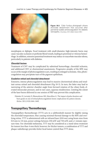 morphopsia or diplopia. Focal treatment with small-­
diameter, high-­
intensity burns may
cause vascular occlusion or perforate blood vessels, leading to preret­
i­
nal or vitreous hemor­
rhage. In addition, extensive panret­i­nal treatment may induce or exacerbate macular edema,
particularly in patients with diabetes.
Choroidal lesions
Treatment of CNV may be complicated by subret­
i­
nal hemorrhage, choroidal ischemia,
and additional CNV or chorioret­
i­
nal anastomosis. Progressive atrophy of the RPE may
occur at the margin of photocoagulation scars, resulting in enlarged scotomata. Also, photo­
coagulation may precipitate tears of the pigment epithelium.
Exudative ret­
i­
nal and choroidal detachment
Extensive, intense photocoagulation may lead to massive chorioret­
i­
nal edema and resul­
tant serous ret­
i­
nal and choroidal detachment (Fig 18-3). In turn, the latter may lead to
narrowing of the anterior chamber ­
angle from forward rotation of the ciliary body, el­
evated intraocular pressure, and in rare cases, aqueous misdirection. Limiting the extent
of the ­
laser burns delivered in one session of PRP may prevent this complication.
Palanker D, Lavinsky D, Blumenkranz MS, Marcellino G. The impact of pulse duration and
burn grade on size of ret­
i­
nal photocoagulation lesion: implications for pattern density.
Ret­i­na. 2011;31(8):1664–1669.
Transpupillary Thermotherapy
Transpupillary thermotherapy (TTT) acts in a subthreshold manner by slightly raising
the choroidal temperature, thus causing minimal thermal damage to the RPE and over­
lying ret­
ina. TTT is administered with an infrared ­
laser (810 nm) using beam sizes from
0.8 mm to 3.0 mm, power settings between 250 mW and 750 mW, and a 1-­
minute expo­
sure time. For choroidal melanoma, TTT may be considered as a stand-­
alone treatment
for tumors less than 4 mm thick; however, for thicker tumors, a combination of TTT and
plaque radiotherapy provides better local tumor control than TTT alone.
Figure 18-3 Color fundus photo­
graph shows
choroidal detachment that occurred ­
after
panret­
i­
nal scatter photocoagulation for diabetic
retinopathy. (Courtesy of M. Gilbert ­
Grand, MD.)
CHAPTER 18: ­
Laser Therapy and Cryotherapy for Posterior Segment Diseases ● 425
 