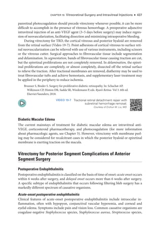 Chapter 19: Vitreoret­
i­
nal Surgery and Intravitreal Injections ● 437
panret­
i­
nal photocoagulation should precede vitrectomy whenever pos­
si­
ble, it can be more
difficult to accomplish in the presence of vitreous hemorrhage. A preoperative adjunctive
intravitreal injection of an anti-­
VEGF agent (3–5 days before surgery) may induce regres-
sion of neovascularization, facilitating dissection and minimizing intraoperative bleeding.
During vitrectomy for TRD, the cortical vitreous and posterior hyaloid are removed
from the ret­
i­
nal surface (Video 19-7). Point adhesions of cortical vitreous to surface ret­
i­
nal neovascularization can be relieved with use of vari­
ous instruments, including scissors
or the vitreous cutter. Surgical approaches to fibrovascular tissue include segmentation
and delamination. In segmentation, bands of fibrovascular tissue causing traction are cut,
but the epiret­
i­
nal proliferations are not completely removed. In delamination, the epiret­
i­
nal proliferations are completely, or almost completely, dissected off the ret­
i­
nal surface
to relieve the traction. ­
After tractional membranes are removed, diathermy may be used to
treat fibrovascular tufts and achieve hemostasis, and supplementary ­
laser treatment may
be applied in the periphery to reduce ischemia.
Brunner S, ­
Binder S. Surgery for proliferative diabetic retinopathy. In: Schachat AP,
Wilkinson CP, Hinton DR, Sadda SR, Wiedemann P, eds. Ryan’s Ret­i­na. Vol 3. 6th ed.
Elsevier/Saunders; 2018.
VIDEO 19-7 Tractional ret­
i­
nal detachment repair with
subret­i­nal hemorrhage removal.
Courtesy of Enchun M. Liu, MD.
Diabetic Macular Edema
The current mainstays of treatment for diabetic macular edema are intravitreal anti-­
VEGF, corticosteroid pharmacotherapy, and photocoagulation (for more information
about pharmacologic agents, see Chapter 5). However, vitrectomy with membrane peel-
ing may be considered for recalcitrant cases in which the posterior hyaloid or epiret­
i­
nal
membrane is exerting traction on the macula.
Vitrectomy for Posterior Segment Complications of Anterior
Segment Surgery
Postoperative Endophthalmitis
Postoperative endophthalmitis is classified on the basis of time of onset: acute onset occurs
within 6 weeks ­
after surgery, and delayed onset occurs more than 6 weeks ­
after surgery.
A specific subtype of endophthalmitis that occurs following filtering bleb surgery has a
markedly dif­
fer­
ent spectrum of causative organisms.
Acute-­
onset postoperative endophthalmitis
Clinical features of acute-­
onset postoperative endophthalmitis include intraocular in-
flammation, often with hypopyon, conjunctival vascular hyperemia, and corneal and
eyelid edema. Symptoms include pain and vision loss. Common causative organisms are
coagulase-­negative Staphylococcus species, Staphylococcus aureus, Streptococcus species,
 