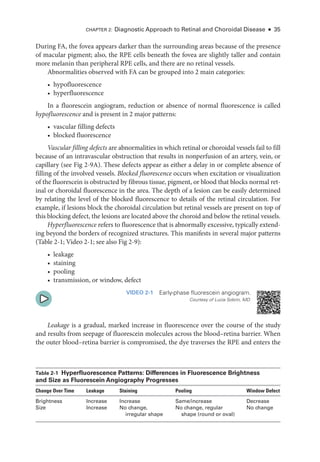 Chapter 2: Diagnostic Approach to Ret­
i­
nal and Choroidal Disease ● 35
During FA, the fovea appears darker than the surrounding areas ­
because of the presence
of macular pigment; also, the RPE cells beneath the fovea are slightly taller and contain
more melanin than peripheral RPE cells, and ­
there are no ret­
i­
nal vessels.
Abnormalities observed with FA can be grouped into 2 main categories:
• hypofluorescence
• hyperfluorescence
In a fluorescein angiogram, reduction or absence of normal fluorescence is called
hypofluorescence and is pre­
sent in 2 major patterns:
• vascular filling defects
• blocked fluorescence
Vascular filling defects are abnormalities in which ret­
i­
nal or choroidal vessels fail to fill
­
because of an intravascular obstruction that results in nonperfusion of an artery, vein, or
capillary (see Fig 2-9A). ­
These defects appear as ­
either a delay in or complete absence of
filling of the involved vessels. Blocked fluorescence occurs when excitation or visualization
of the fluorescein is obstructed by fibrous tissue, pigment, or blood that blocks normal ret­
i­
nal or choroidal fluorescence in the area. The depth of a lesion can be easily determined
by relating the level of the blocked fluorescence to details of the ret­
i­
nal circulation. For
example, if lesions block the choroidal circulation but ret­
i­
nal vessels are pre­
sent on top of
this blocking defect, the lesions are located above the choroid and below the ret­
i­
nal vessels.
Hyperfluorescence refers to fluorescence that is abnormally excessive, typically extend-
ing beyond the borders of recognized structures. This manifests in several major patterns
(­Table 2-1; Video 2-1; see also Fig 2-9):
• leakage
• staining
• pooling
• transmission, or win­
dow, defect
VIDEO 2-1 Early-­
phase fluorescein angiogram.
Courtesy of Lucia Sobrin, MD.
Leakage is a gradual, marked increase in fluorescence over the course of the study
and results from seepage of fluorescein molecules across the blood–­
retina barrier. When
the outer blood–­
retina barrier is compromised, the dye traverses the RPE and enters the
­Table 2-1 Hyperfluorescence Patterns: Differences in Fluorescence Brightness
and Size as Fluorescein Angiography Progresses
Change Over Time Leakage Staining Pooling Win­dow Defect
Brightness Increase Increase Same/increase Decrease
Size Increase No change,
irregular shape
No change, regular
shape (round or oval)
No change
 
