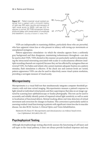 56 ● Retina and Vitreous
VEPs are indispensable in examining ­
children, particularly ­
those who are preverbal,
who have apparent vision loss or who pre­
sent in infancy with roving eye movements or
unexplained nystagmus.
Pattern-­
appearance stimulation—in which the stimulus appears from a uniformly
gray background and then dis­
appears, maintaining isoluminance throughout—­
can also
be used to elicit VEPs. VEPs elicited in this manner are particularly useful in demonstrat­
ing the intracranial misrouting associated with ocular or oculocutaneous albinism (mul­
tiple recording channels are required) ­because they are less affected by nystagmus than are
reversal VEPs. For babies and infants who cannot maintain adequate fixation on a pattern
stimulus, flash stimulation is effective. If the check size and contrast levels are varied,
pattern-­
appearance VEPs can also be used to objectively assess visual system resolution,
providing a surrogate mea­
sure of visual acuity.
Microperimetry
Microperimetry is a visual field test that si­
mul­
ta­
neously integrates computer threshold pe­
rimetry with real-­
time ret­
i­
nal imaging. Microperimeters mea­
sure a patient’s response to
light stimuli at individual ret­
i­
nal points and then superimpose that data on an image cap­
tured by scanning ­
laser ophthalmoscopy or fundus photography. This test can be used to
accurately and reliably identify points of impaired ret­
i­
nal light sensitivity as well as assist
in localization of functional defects. Ret­
i­
nal tracking allows real-­
time detection of ret­
i­
nal
movement and correction for changes in fixation. This correction is particularly useful in
assessing residual visual functioning in patients with significant vision loss due to macular
disease. See also BCSC Section 3, Clinical Optics and Vision Rehabilitation.
Markowitz SN, Reyes SV. Microperimetry and clinical practice: an evidence-­
based review.
Can J Ophthalmol. 2013;48(5):350–357.
Psychophysical Testing
Although electrophysiologic testing objectively assesses the functioning of cell layers and
cell types in the visual pathway, it does not always provide localized responses and may
RE
LE
P100
P100
N135
100 ms
5 μV
Figure 3-7 Pattern-­
reversal visual evoked po-
tential from a patient with a 4-­
month history
of right eye (RE) optic neuritis and recovery of
right visual acuity to 20/20. Left eye (LE) re-
sponse is normal; RE P100 component shows
profound delay with preservation of amplitude
and waveform. (Courtesy of Graham E. Holder, PhD.)
 