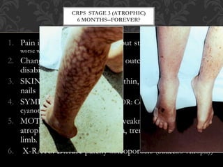 Cprs Rash CRPS (Complex regional pain syndrome) | PPTX