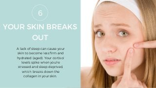 YOUR SKIN BREAKS
OUT
A lack of sleep can cause your
skin to become less firm and
hydrated (aged). Your cortisol
levels spike when you're
stressed and sleep deprived,
which breaks down the
collagen in your skin.
6
 