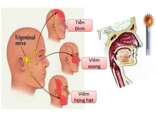 Tiền
Đình




       Viêm
       xoang




  Viêm
họng hạt
 