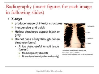 Radiography (insert figures for each image in following slides) X-rays  produce image of interior structures Inexpensive and quick Hollow structures appear black or gray Do not pass easily through dense structure (bone) At low dose, useful for soft tissue (breast) Mammography (breast) Bone densitometry (bone density) Copyright 2009, John Wiley & Sons, Inc. 