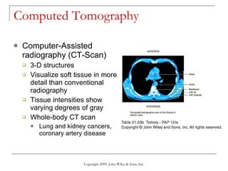 Computed Tomography Computer-Assisted radiography (CT-Scan) 3-D structures Visualize soft tissue in more detail than conventional radiography Tissue intensities show varying degrees of gray Whole-body CT scan Lung and kidney cancers, coronary artery disease Copyright 2009, John Wiley & Sons, Inc. 
