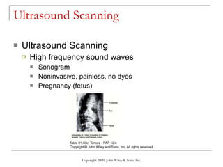 Ultrasound Scanning Ultrasound Scanning High frequency sound waves Sonogram Noninvasive, painless, no dyes Pregnancy (fetus) Copyright 2009, John Wiley & Sons, Inc. 