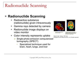 Radionuclide Scanning Radionuclide Scanning Radioactive substance (radionuclide) given intravenously Gamma rays detected by camera Radionuclide image displays on video monitor Color intensity represents uptake Single-photo-emission computerized tomography (SPECT) Specialized technique used for brain, heart, lungs, and liver Copyright 2009, John Wiley & Sons, Inc. 