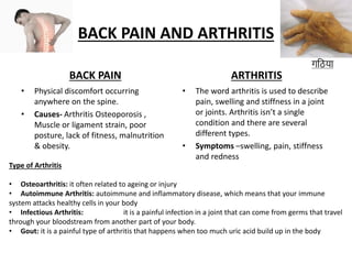 BACK PAIN AND ARTHRITIS
BACK PAIN
• Physical discomfort occurring
anywhere on the spine.
• Causes- Arthritis Osteoporosis ,
Muscle or ligament strain, poor
posture, lack of fitness, malnutrition
& obesity.
ARTHRITIS
• The word arthritis is used to describe
pain, swelling and stiffness in a joint
or joints. Arthritis isn’t a single
condition and there are several
different types.
• Symptoms –swelling, pain, stiffness
and redness
गठिया
Type of Arthritis
• Osteoarthritis: it often related to ageing or injury
• Autoimmune Arthritis: autoimmune and inflammatory disease, which means that your immune
system attacks healthy cells in your body
• Infectious Arthritis: it is a painful infection in a joint that can come from germs that travel
through your bloodstream from another part of your body.
• Gout: it is a painful type of arthritis that happens when too much uric acid build up in the body
 