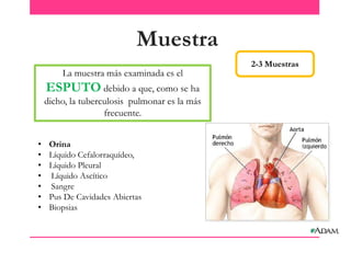 Muestra
La muestra más examinada es el

ESPUTO debido a que, como se ha
dicho, la tuberculosis pulmonar es la más
frecuente.
•
•
•
•
•
•
•

Orina
Líquido Cefalorraquídeo,
Líquido Pleural
Líquido Ascítico
Sangre
Pus De Cavidades Abiertas
Biopsias

2-3 Muestras

 