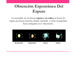 Obtención Espontánea Del
Esputo
La necesidad de recolectar esputo y no saliva, la forma de
lograr una buena muestra, dónde colectarla y cómo manipularla
hasta entregarla en el laboratorio.

 