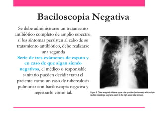 Baciloscopia Negativa
Se debe administrarse un tratamiento
antibiótico completo de amplio espectro;
si los síntomas persisten al cabo de su
tratamiento antibiótico, debe realizarse
una segunda
Serie de tres exámenes de esputo y
en caso de que sigan siendo
negativos, el médico o responsable
sanitario pueden decidir tratar el
paciente como un caso de tuberculosis
pulmonar con baciloscopia negativa y
registrarlo como tal.

 