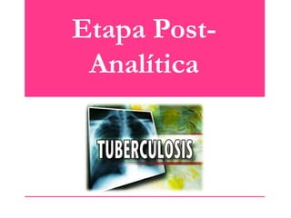 Etapa PostAnalítica

 