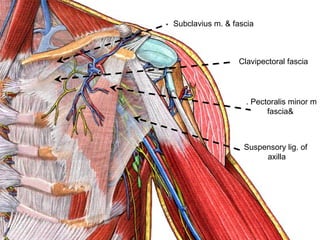 Pectoralis minor m.
&fascia
Suspensory lig. of
axilla
Clavipectoral fascia
Subclavius m. & fascia
 