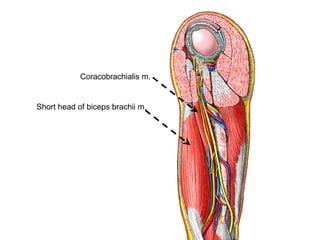 Coracobrachialis m.
Short head of biceps brachii m.
 