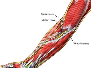 Median nerve
Brachial artery
Radial nerve
 