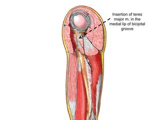 Insertion of teres
major m. in the
medial lip of bicipital
groove
 