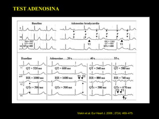 TEST ADENOSINA

Viskin et al. Eur Heart J. 2006 ; 27(4): 469–475.

 