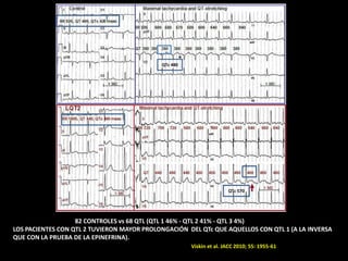 QTc 480

QTc 570

82 CONTROLES vs 68 QTL (QTL 1 46% - QTL 2 41% - QTL 3 4%)
LOS PACIENTES CON QTL 2 TUVIERON MAYOR PROLONGACIÓN DEL QTc QUE AQUELLOS CON QTL 1 (A LA INVERSA
QUE CON LA PRUEBA DE LA EPINEFRINA).
(

Viskin et al. JACC 2010; 55: 1955-61

 