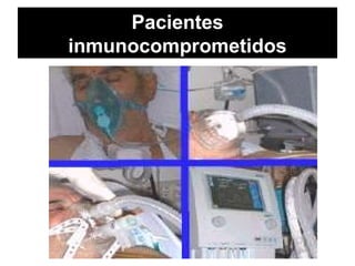 Pacientes
inmunocomprometidos
 