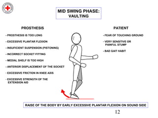12
MID SWING PHASE:
VAULTING
- PROSTHESIS IS TOO LONG
- EXCESSIVE PLANTAR FLEXION
- INSUFICIENT SUSPENSION (PISTONING)
- INCORRECT SOCKET FITTING
- MEDIAL SHELF IS TOO HIGH
- ANTERIOR DISPLACEMENT OF THE SOCKET
- EXCESSIVE FRICTION IN KNEE AXIS
- EXCESSIVE STRENGTH OF THE
EXTENSION AID
PROSTHESIS
- FEAR OF TOUCHING GROUND
- VERY SENSITIVE OR
PAINFUL STUMP
- BAD GAIT HABIT
PATIENT
RAISE OF THE BODY BY EARLY EXCESSIVE PLANTAR FLEXION ON SOUND SIDE
 
