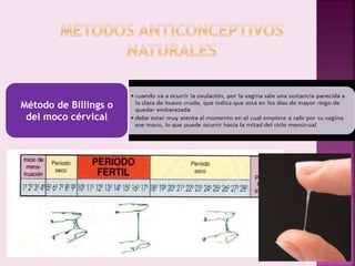Método de Billings o
del moco cérvical
 
