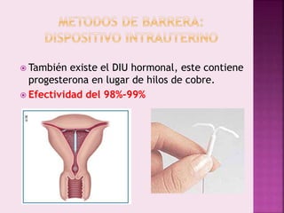  También existe el DIU hormonal, este contiene
progesterona en lugar de hilos de cobre.
 Efectividad del 98%-99%
 