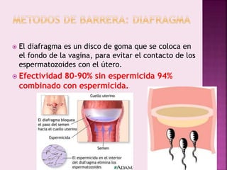  El diafragma es un disco de goma que se coloca en
el fondo de la vagina, para evitar el contacto de los
espermatozoides con el útero.
 Efectividad 80-90% sin espermicida 94%
combinado con espermicida.
 