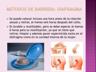  Se puede colocar incluso una hora antes de la relación
sexual y retirar, al menos seis horas después del coito.
 Es lavable y reutilizable, pero se debe esperar al menos
6 horas para su reutilización, ya que se tiene que
retirar, limpiar y además poner espermicida tanto en el
diafragma como en la cavidad interna de la mujer.
 
