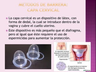 La capa cervical es un dispositivo de látex, con
forma de dedal, la cual se introduce dentro de la
vagina y cubre el cuello uterino.
 Este dispositivo es más pequeño que el diafragma,
pero al igual que éste requiere el uso de
espermicidas para aumentar la protección.
 