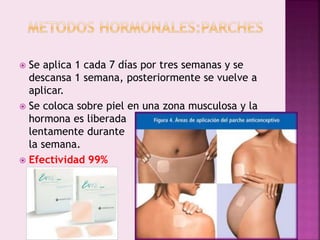  Se aplica 1 cada 7 días por tres semanas y se
descansa 1 semana, posteriormente se vuelve a
aplicar.
 Se coloca sobre piel en una zona musculosa y la
hormona es liberada
lentamente durante
la semana.
 Efectividad 99%
 
