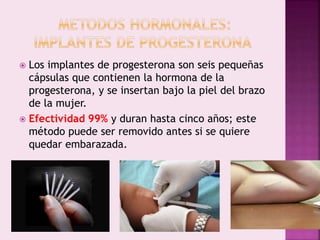 Los implantes de progesterona son seis pequeñas
cápsulas que contienen la hormona de la
progesterona, y se insertan bajo la piel del brazo
de la mujer.
 Efectividad 99% y duran hasta cinco años; este
método puede ser removido antes si se quiere
quedar embarazada.
 
