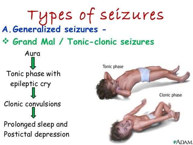 grand mal seizure 13 antiparkinsonian drugs antiepileptics grand mal seizure 13 antiparkinsonian drugs antiepileptics