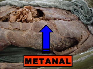 METANAL
 