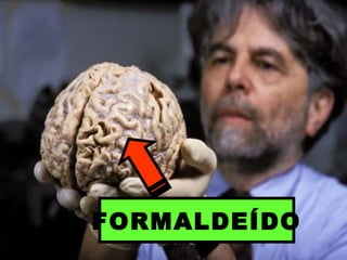 FORMALDEÍDO
 